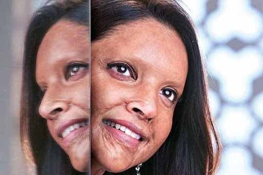 Deepika Padukone Sebut Perannya Dalam Film Chhapaak Merupakan Peran Terkuat di Sepanjang Karirnya