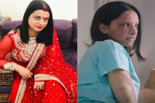 Trailer Chhapaak Resmi Rilis, Rangoli Chandel Beri Dukungan Pada Deepika Padukone