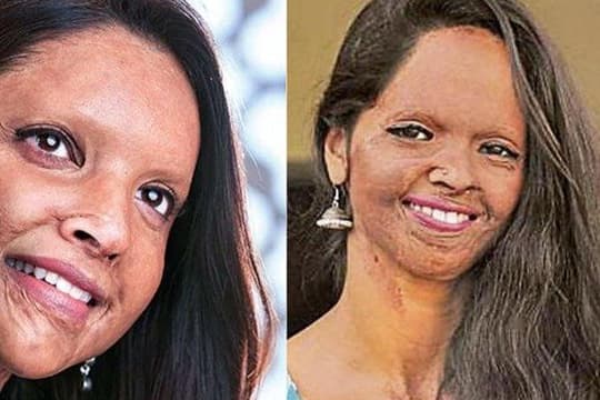 Unggah Tampilan Pertama Film Chhapaak, Deepika Padukone Tuai Pujian